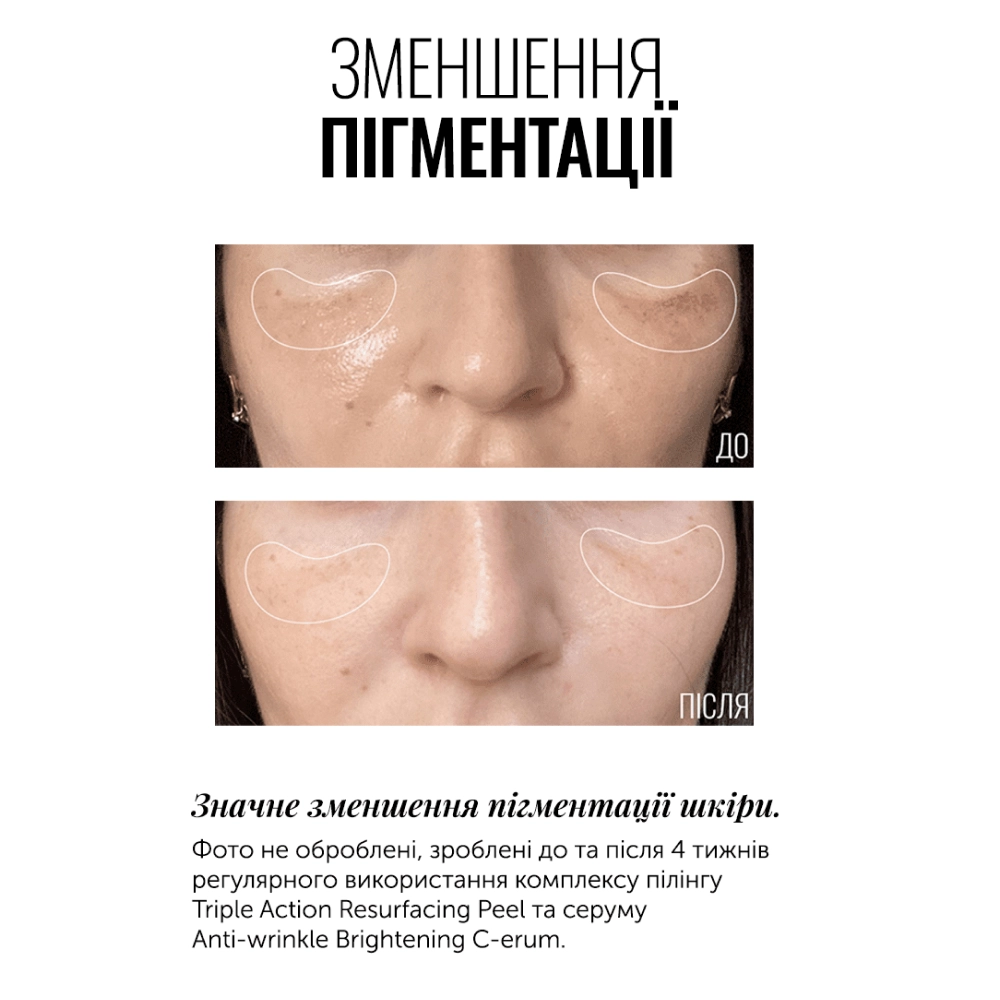 Суперконцентрированный серум с витамином С Anti-Wrinkle Brightening C-erum INSTYTUTUM Объем 30 мл — фото 4