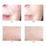 Сыворотка "Актив серум" Active Serum IS CLINICAL Объем 15 мл — фото 4