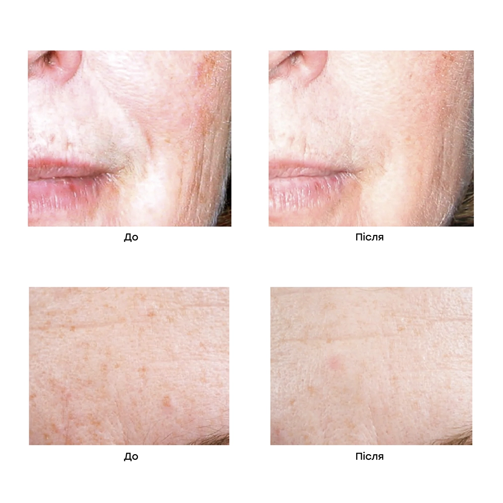 Сыворотка "Актив серум" Active Serum IS CLINICAL Объем 15 мл — фото 4