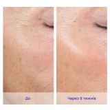 Активная пилинговая система для домашнего ухода Active Peel System IS CLINICAL — фото 6