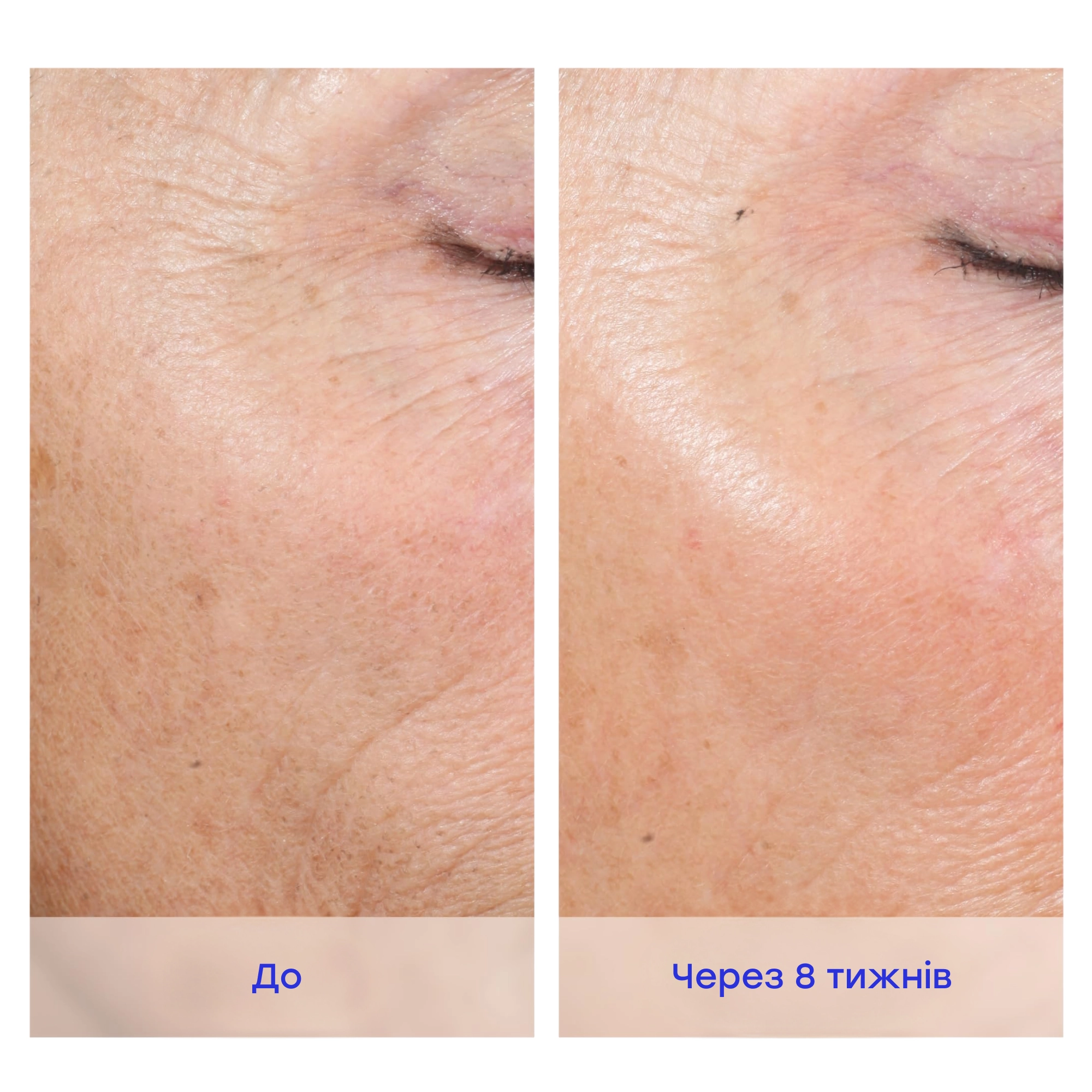 Активная пилинговая система для домашнего ухода Active Peel System IS CLINICAL — фото 6