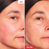 Нічна двофазна олійна сироватка для обличчя Skin Therapy ERBORIAN Обʼєм 10 мл — фото 3