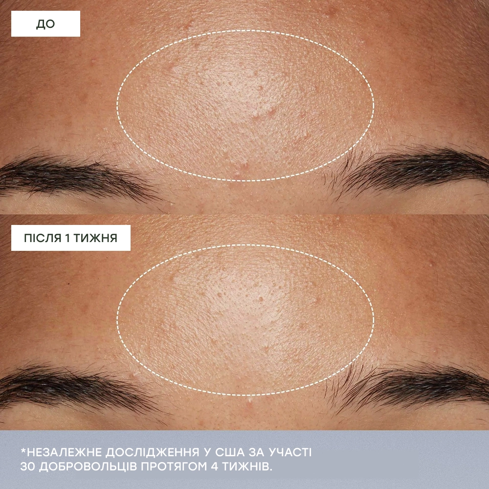 Щоденний мікрофоліант у тревел розмірі Daily Microfoliant travel size DERMALOGICA Вага 13 г — фото 6