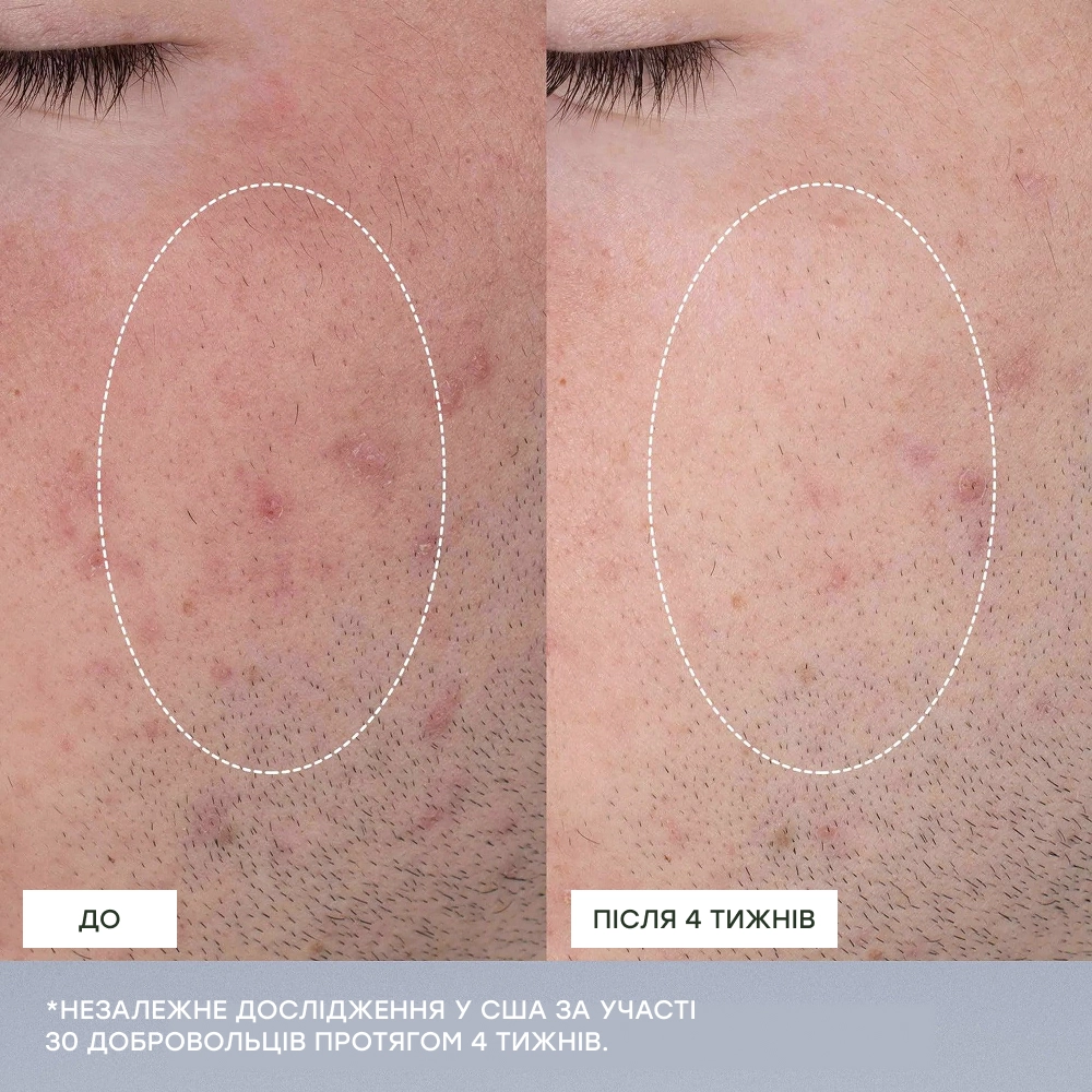 Щоденний мікрофоліант (змінний блок) Daily Microfoliant Refill DERMALOGICA Вага 74 г — фото 5