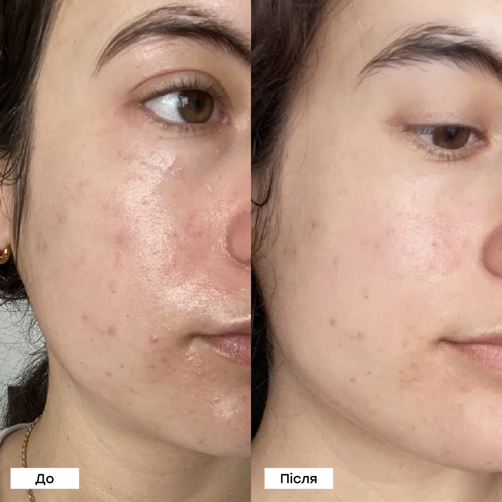 Зволожуючий відновлюючий крем для обличчя Barrier Restoring Hydrating Cream TRANSPARENT LAB Обʼєм 50 мл — фото 6