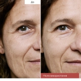 Нічна молочна сироватка для обличчя Skin Therapy – Multi-Perfecting ERBORIAN Обʼєм 10 мл — фото 3