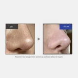 Сироватка з екзосомами та спікулами для звуження пор 2000 One Day Exosome Shot Pore Ampoule 2000 MEDICUBE Обʼєм 30 мл — фото 5