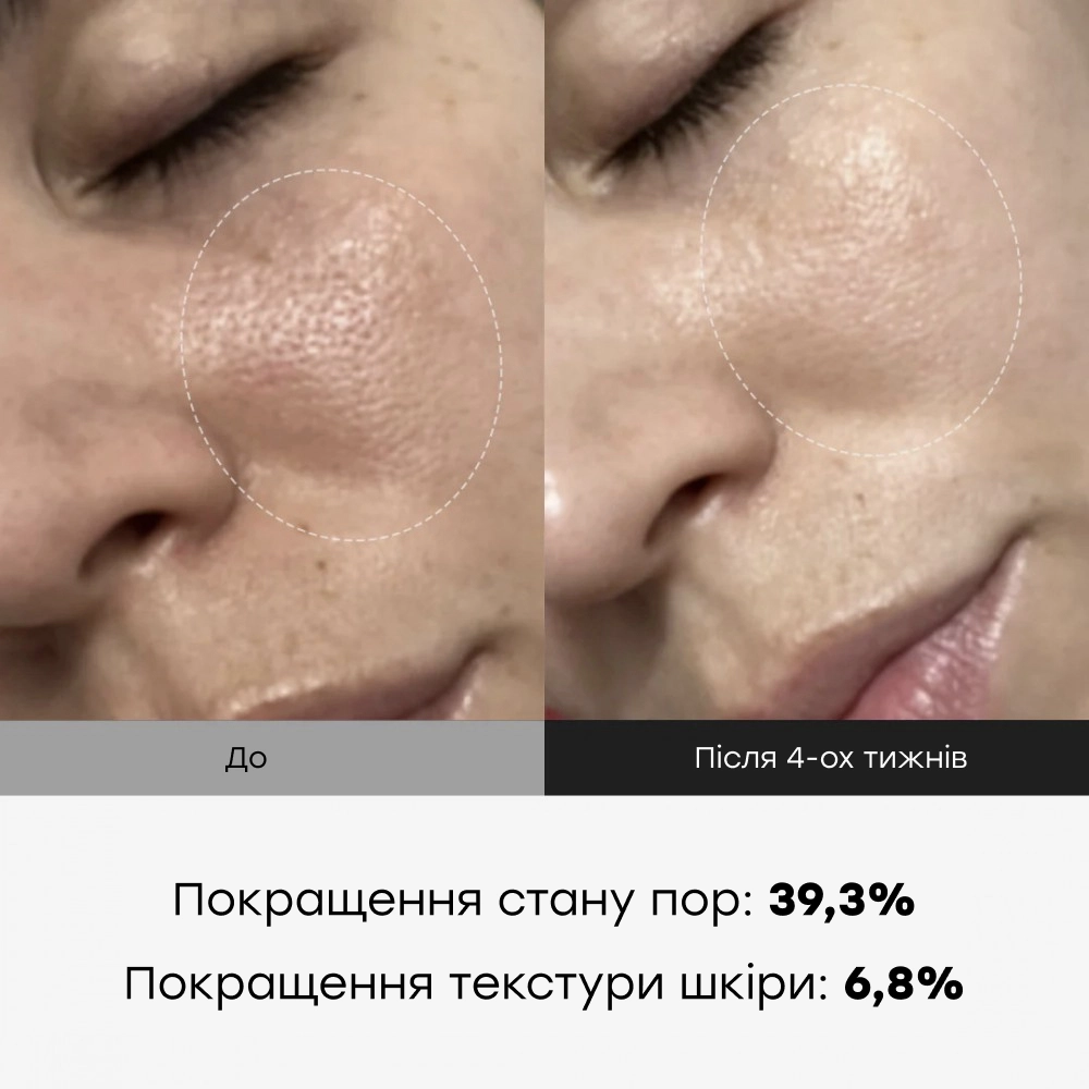 Сироватка з екзосомами та спікулами для звуження пор 2000 One Day Exosome Shot Pore Ampoule 2000 MEDICUBE Обʼєм 30 мл — фото 4