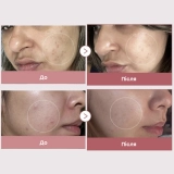 Восстанавливающая сыворотка с молекулами ДНК и розовыми пептидами Pdrn Pink Peptide Serum MEDICUBE Объем 30 мл — фото 7