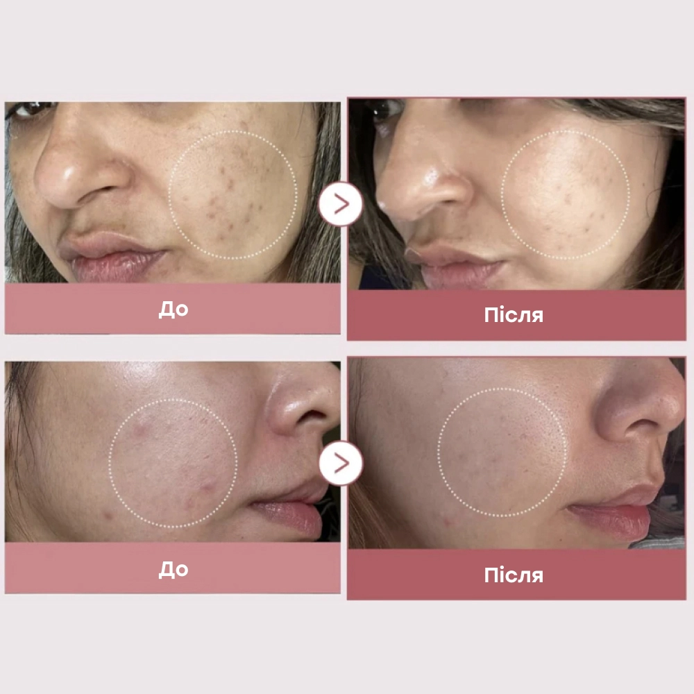Восстанавливающая сыворотка с молекулами ДНК и розовыми пептидами Pdrn Pink Peptide Serum MEDICUBE Объем 30 мл — фото 7