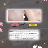 Гідрогелева маска з PDRN та колагеном Pdrn Pink Collagen Gel Mask MEDICUBE Вага 28 г — фото 6