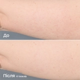 Разглаживающая сыворотка для тела Kaleidoscope Body Serum JOONBYRD Объем 100 мл — фото 7