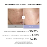 Міні-пристрій для домашнього догляду за шкірою Age-r Booster Pro Mini MEDICUBE Відтінок Pink — фото 3