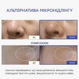 Регенеруюча сироватка з полінуклеотидами, екзосомами та спікулами Pdrn Pink Collagen Exosome Shot 7500 MEDICUBE Обʼєм 30 мл — фото 4