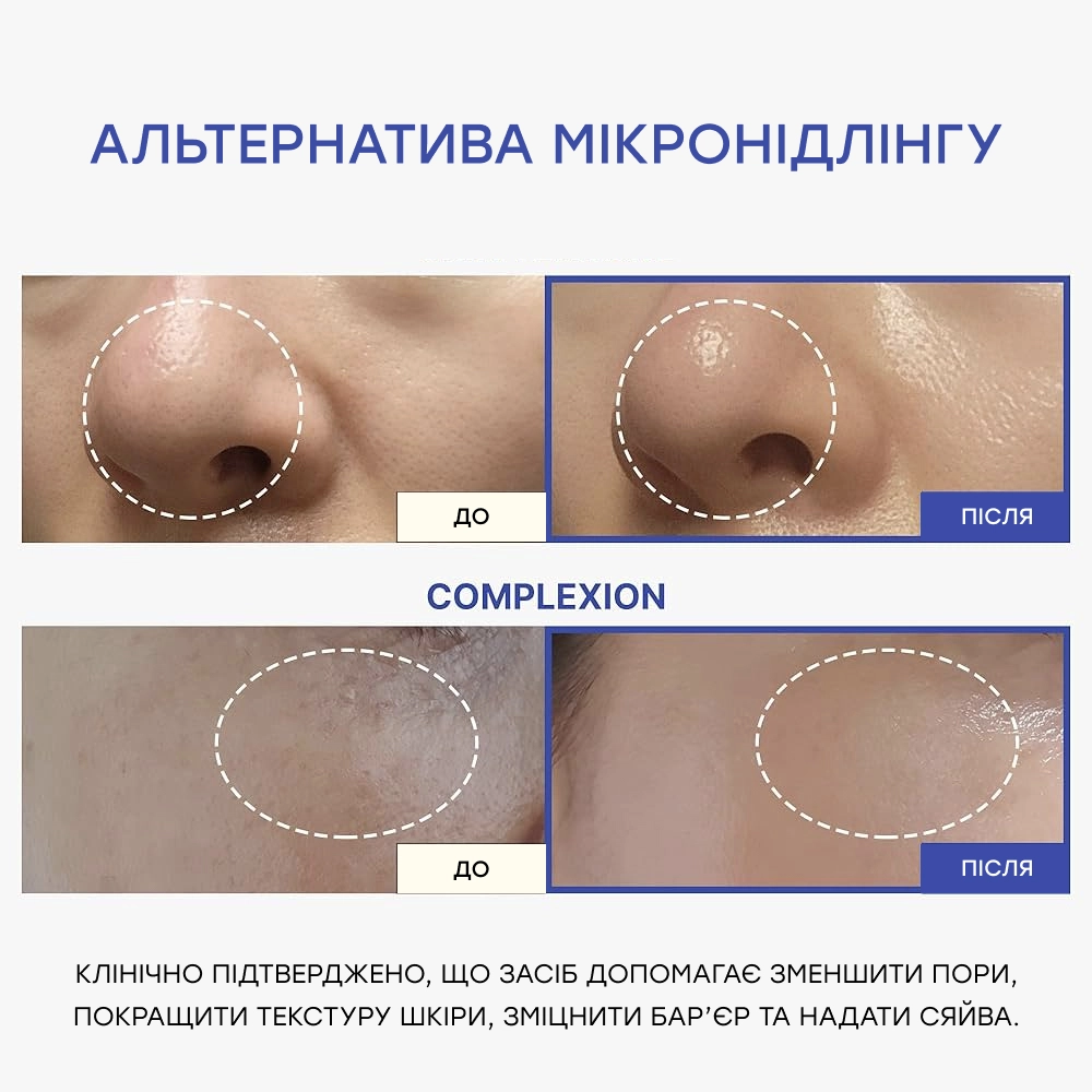 Регенеруюча сироватка з полінуклеотидами, екзосомами та спікулами Pdrn Pink Collagen Exosome Shot 7500 MEDICUBE Обʼєм 30 мл — фото 4