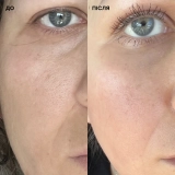 Себорегулюючий крем для обличчя Medicube Zero Pore Cream 2.0 MEDICUBE Обʼєм 50 мл — фото 4