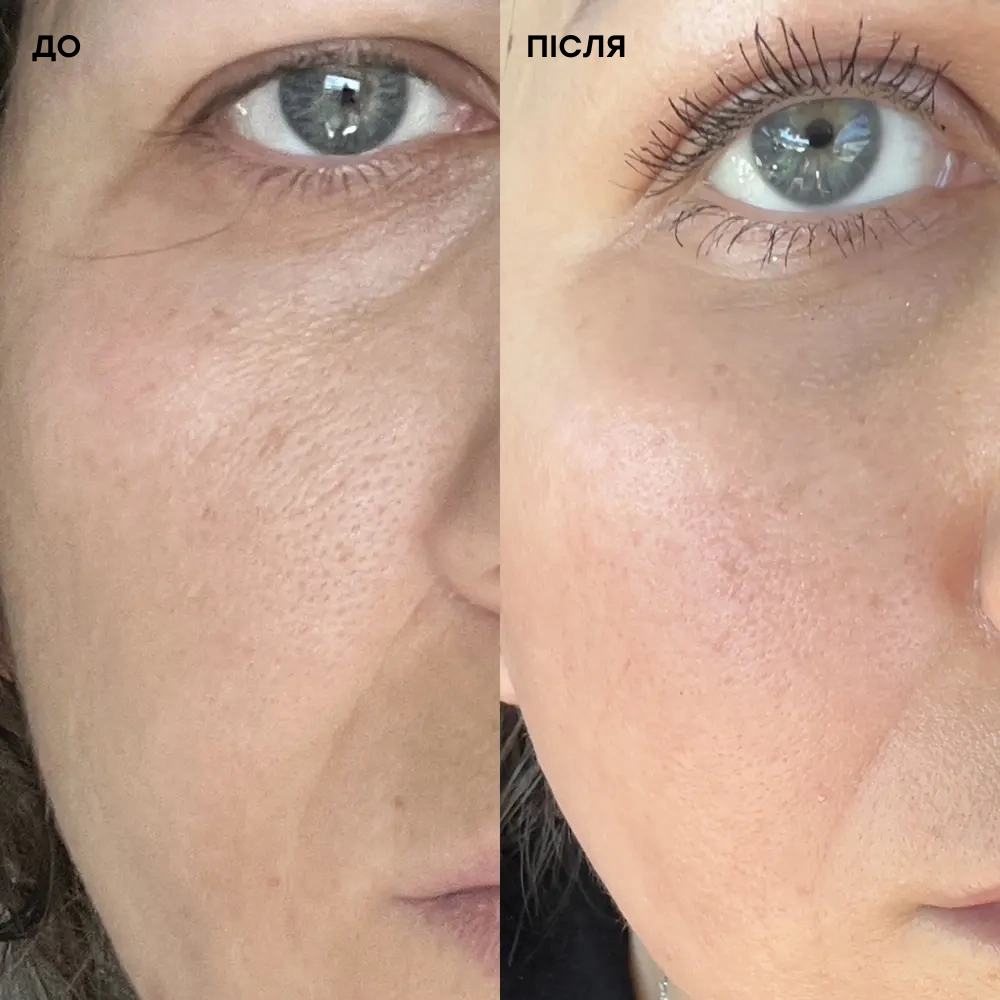 Себорегулюючий крем для обличчя Medicube Zero Pore Cream 2.0 MEDICUBE Обʼєм 50 мл — фото 4
