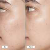 Очищающие пилинг-диски с гликолевой кислотой Glow Peel Pads PIXI — фото 4