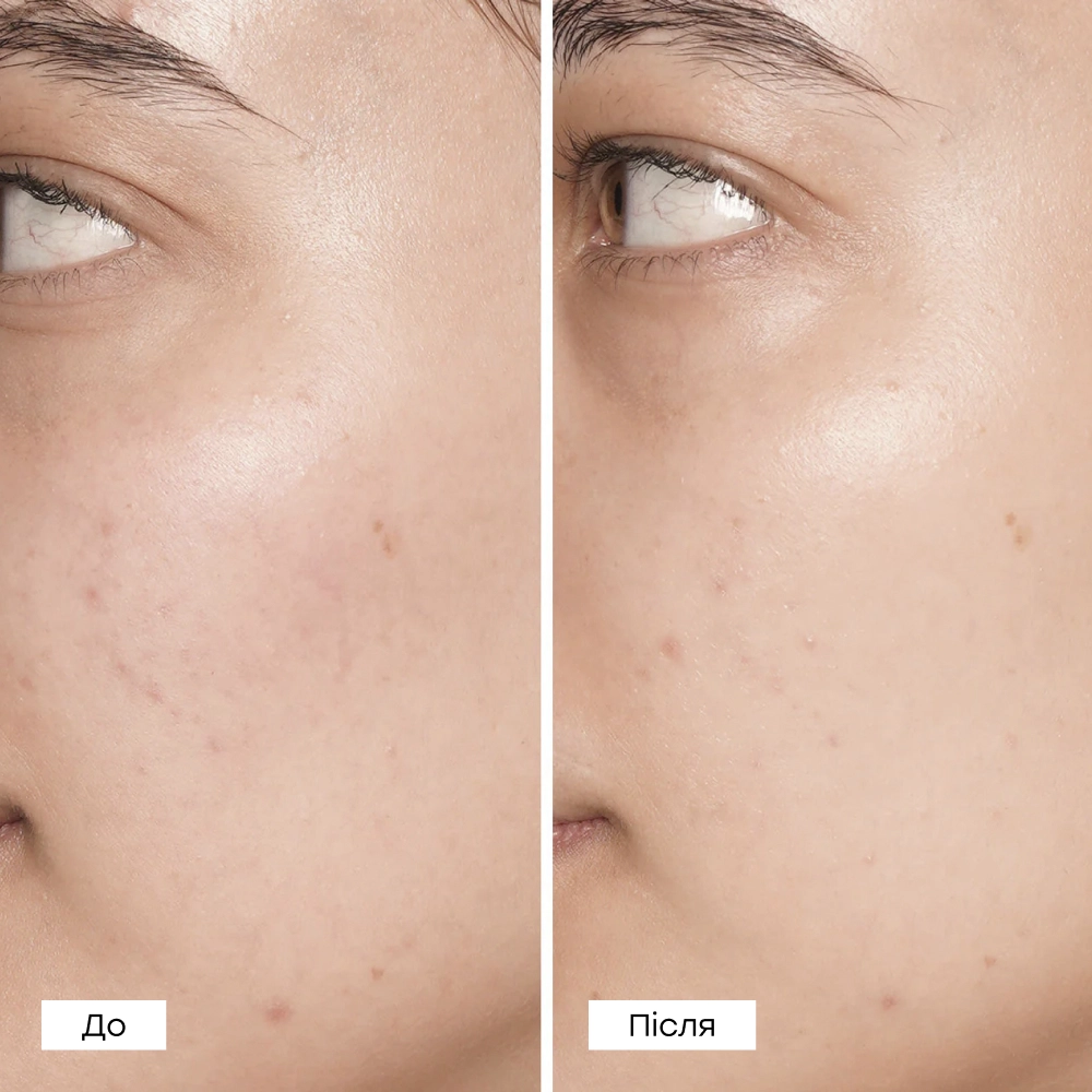 Очищающие пилинг-диски с гликолевой кислотой Glow Peel Pads PIXI — фото 4