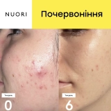 Очищувальна пінка для обличчя Vital Foaming Cleanser NUORI Обʼєм 30 мл — фото 5