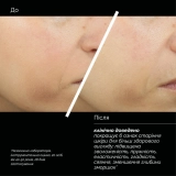 Трипептидный антивозрастной лифтинговый гель-крем Skin Regimen Lx Tripeptide Gel Cream COMFORT ZONE Объем 50 мл — фото 4