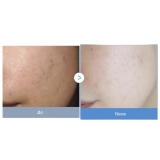 Зволожувальний тонер для догляду за розширеними порами Zero Pore Toner MEDICUBE Обʼєм 250 мл — фото 4