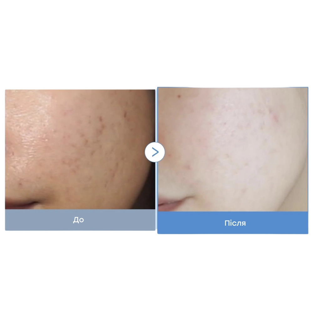 Зволожувальний тонер для догляду за розширеними порами Zero Pore Toner MEDICUBE Обʼєм 250 мл — фото 4