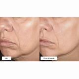 Нейроскульптуруюча ліфтинг-сироватка для обличчя Neurotouch Symmetry Serum DERMALOGICA Обʼєм 30 мл — фото 5