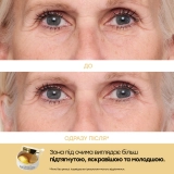 Дорожный набор патчей для зоны вокруг глаз Eye Patch Travel Pack "Patch + Go" 4 pairs PETER THOMAS ROTH — фото 4