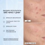 Сыворотка с 10% ниацинамидом и пептидами Niacinamide Peptides MEDIK8 Объем 30 мл — фото 4