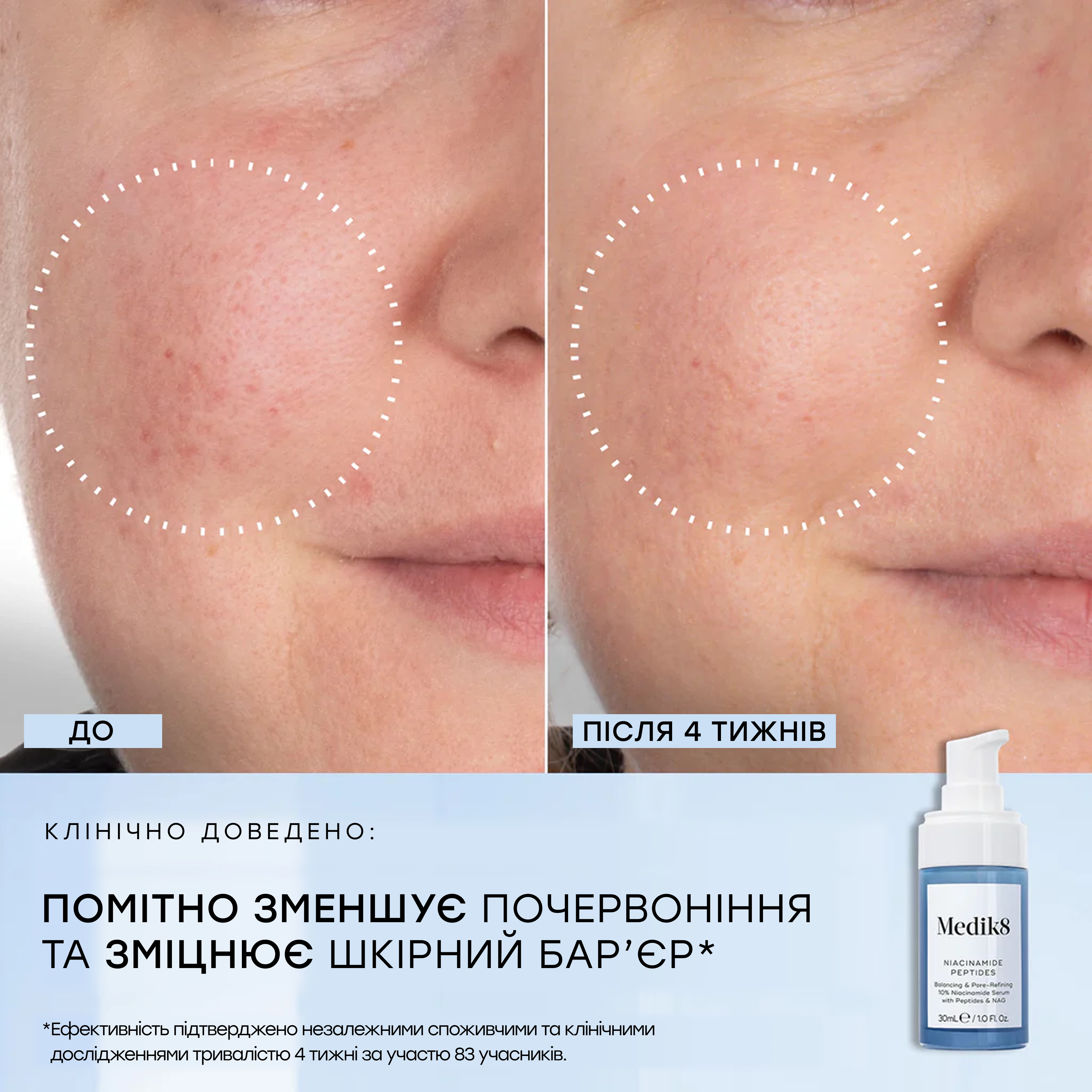 Сыворотка с 10% ниацинамидом и пептидами Niacinamide Peptides MEDIK8 Объем 30 мл — фото 3