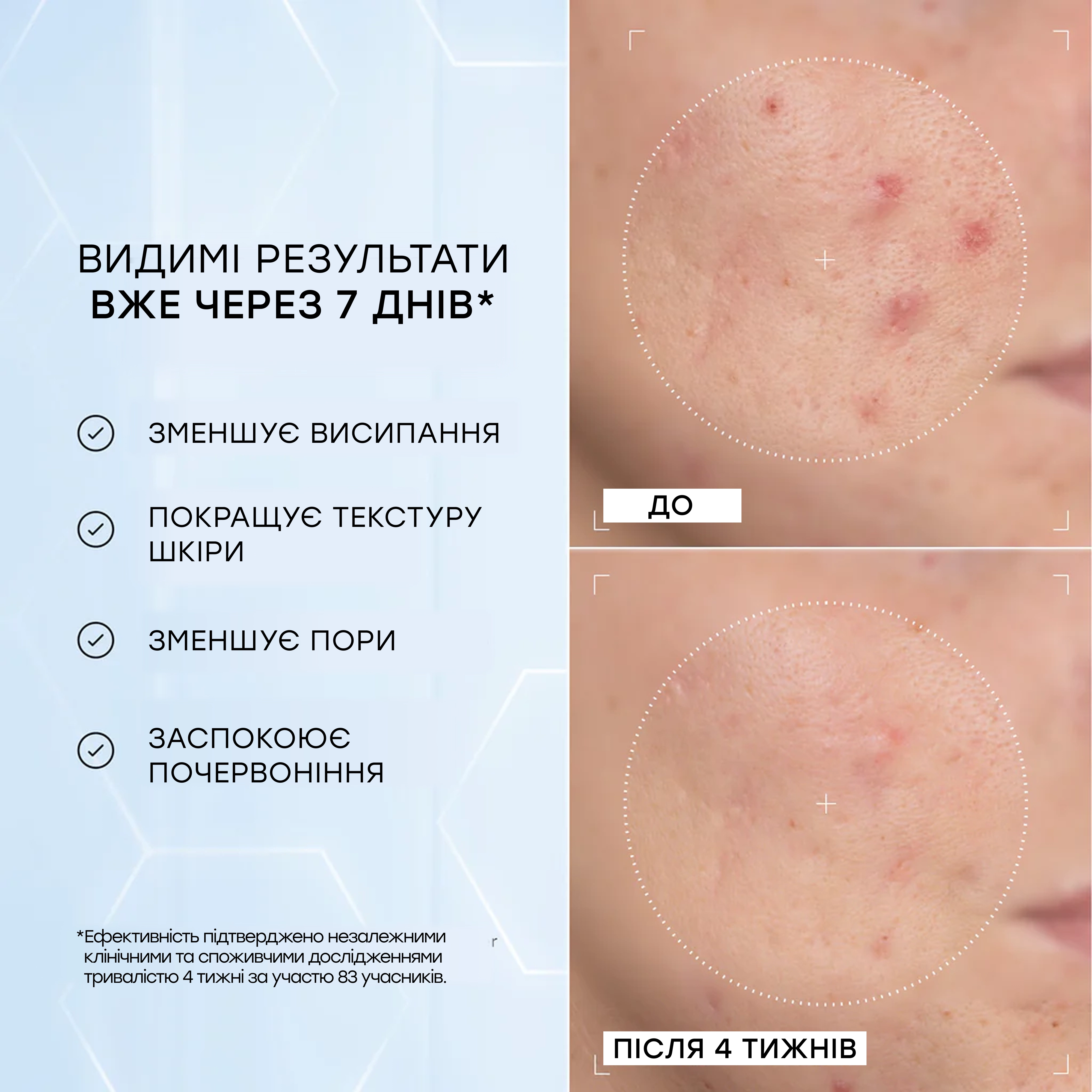 Сыворотка с 10% ниацинамидом и пептидами Niacinamide Peptides MEDIK8 Объем 30 мл — фото 4