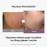 Тонер-молочко з глутатіоном для освітлення та сяйва AGE-R Glutathione Glow Toner MEDICUBE Обʼєм 140 мл — фото 6
