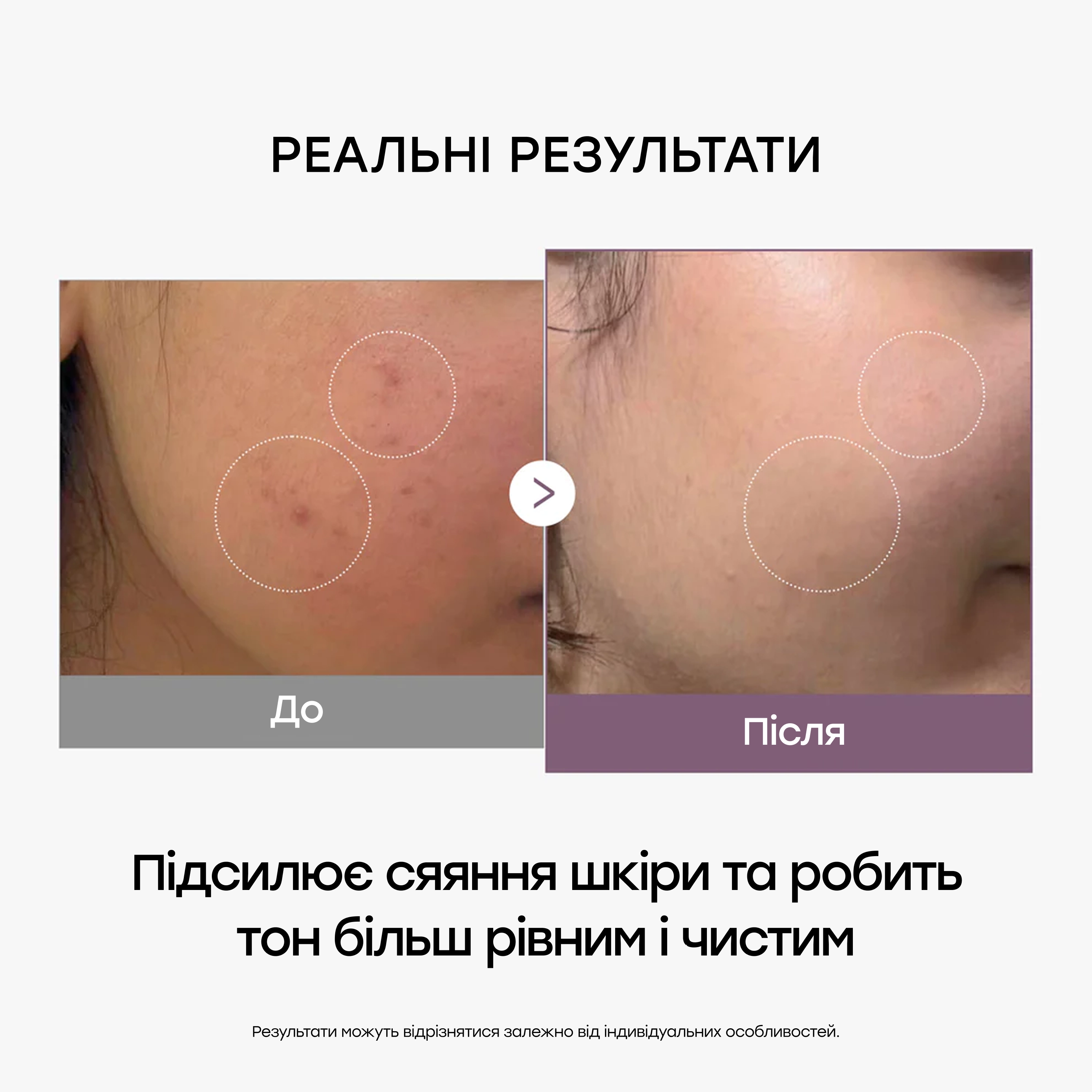 Тонер-молочко з глутатіоном для освітлення та сяйва AGE-R Glutathione Glow Toner MEDICUBE Обʼєм 140 мл — фото 6