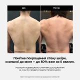 Протизапальний гель для душу з кислотами Red Acne Body Wash MEDICUBE Обʼєм 400 мл — фото 6