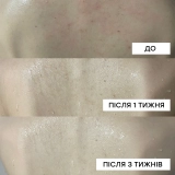 Протизапальний гель для душу з кислотами Red Acne Body Wash MEDICUBE Обʼєм 400 мл — фото 8