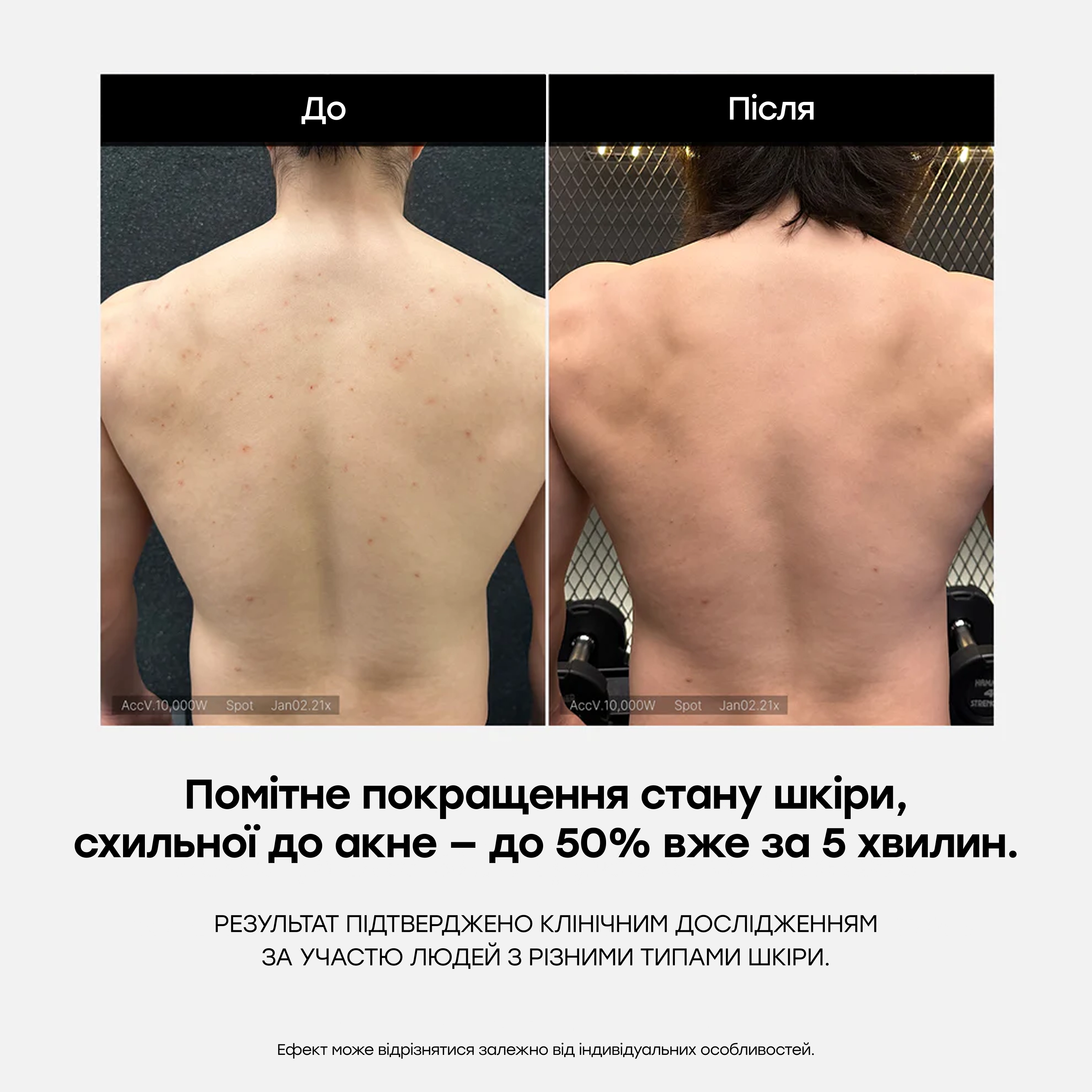 Протизапальний гель для душу з кислотами Red Acne Body Wash MEDICUBE Обʼєм 400 мл — фото 6