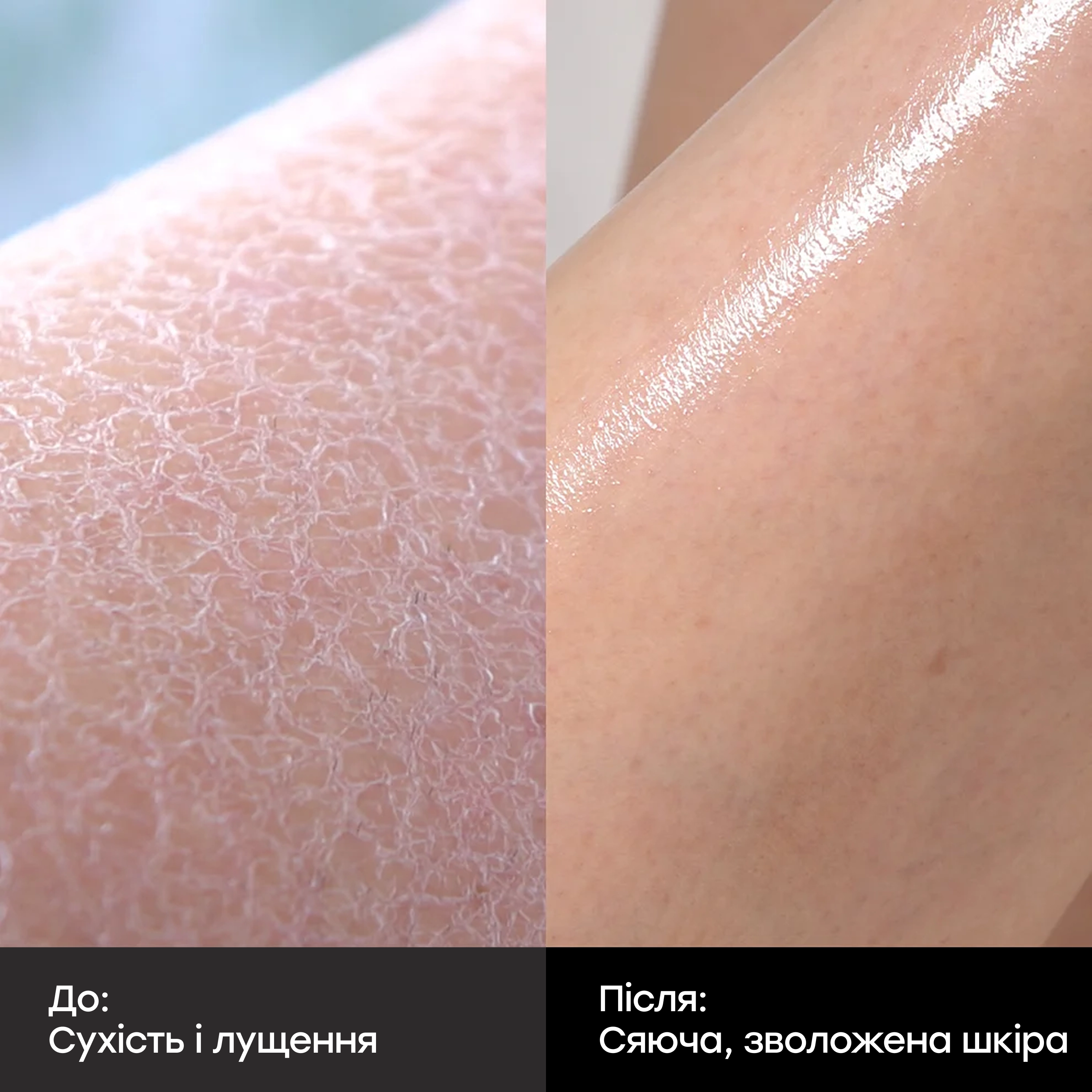Протизапальний гель для душу з кислотами Red Acne Body Wash MEDICUBE Обʼєм 400 мл — фото 7