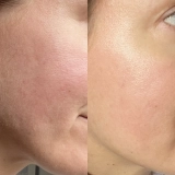 Сироватка для сяйва та пружності шкіри The Glow Serum – Skin-Elevating Radiance Serum MANTLE Обʼєм 30 мл — фото 5