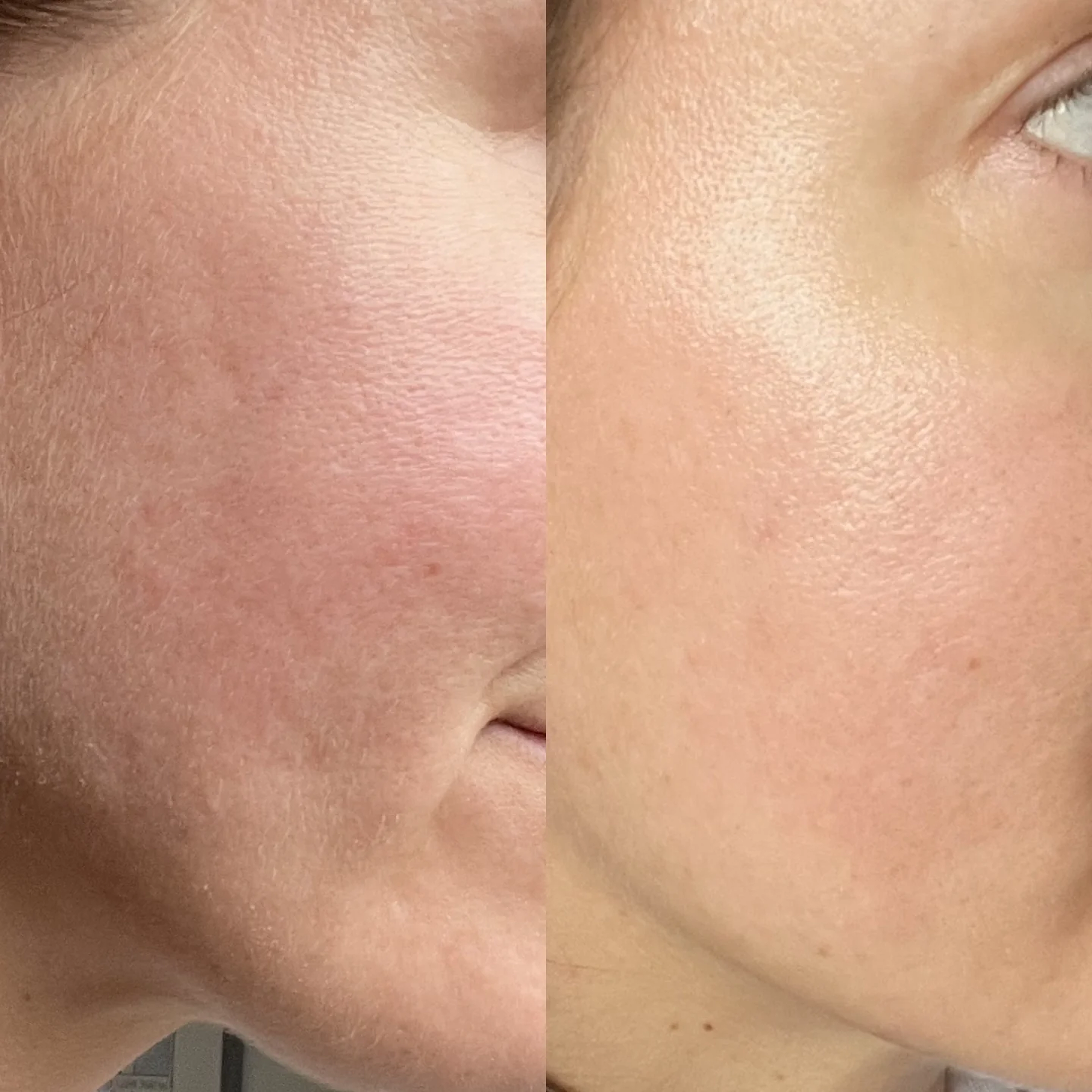 Сироватка для сяйва та пружності шкіри The Glow Serum – Skin-Elevating Radiance Serum MANTLE Обʼєм 30 мл — фото 5