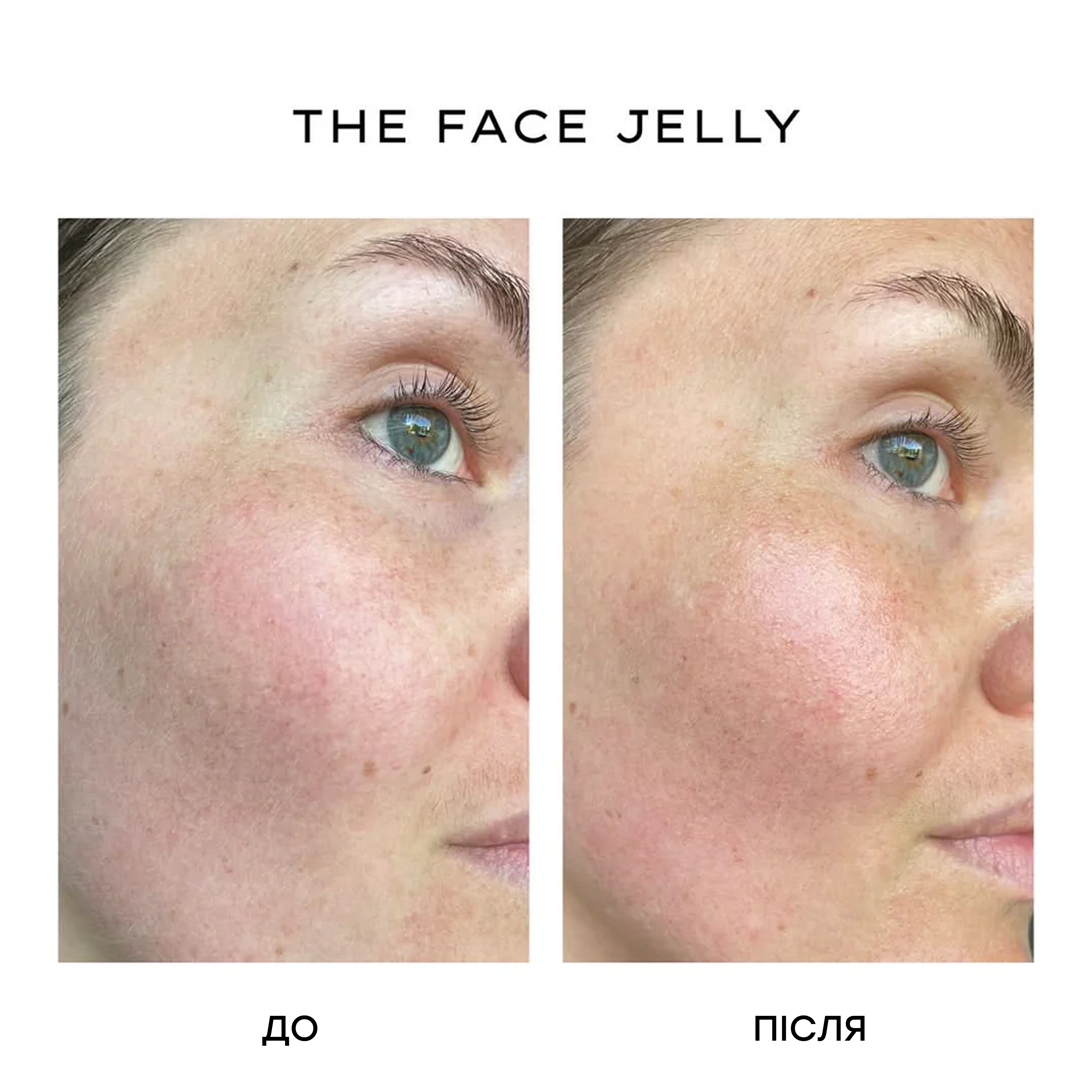 Гель-крем для увлажнения и успокоения кожи с центеллой The Face Jelly – Soothing Centella Gel MANTLE Объем 50 мл — фото 7