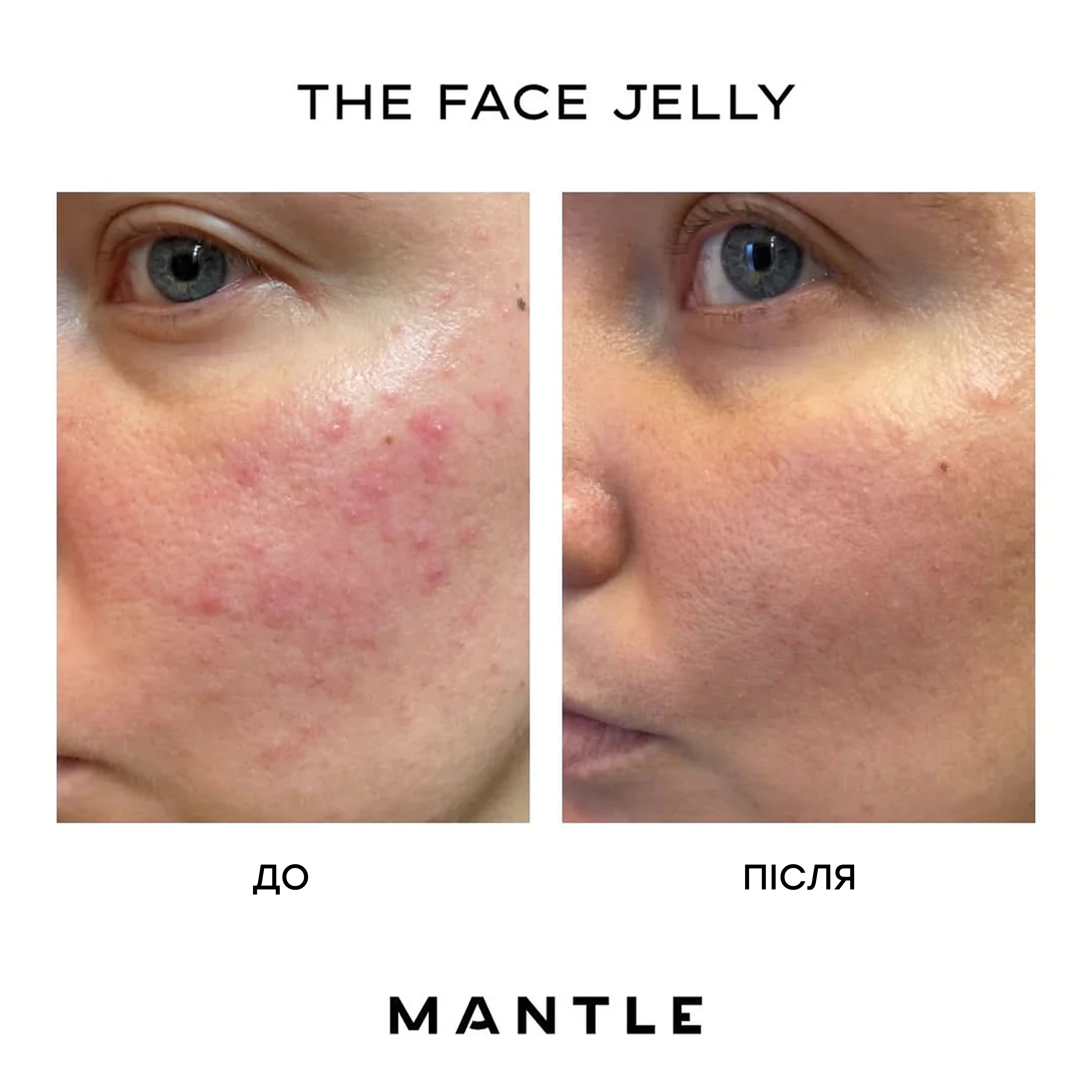 Гель-крем для увлажнения и успокоения кожи с центеллой The Face Jelly – Soothing Centella Gel MANTLE Объем 50 мл — фото 8