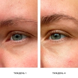 Крем для шкіри навколо очей проти набряків і темних кіл The Eye De-Puffer – Brightening + De-Puffing Eye Cream MANTLE Обʼєм 15 мл — фото 5