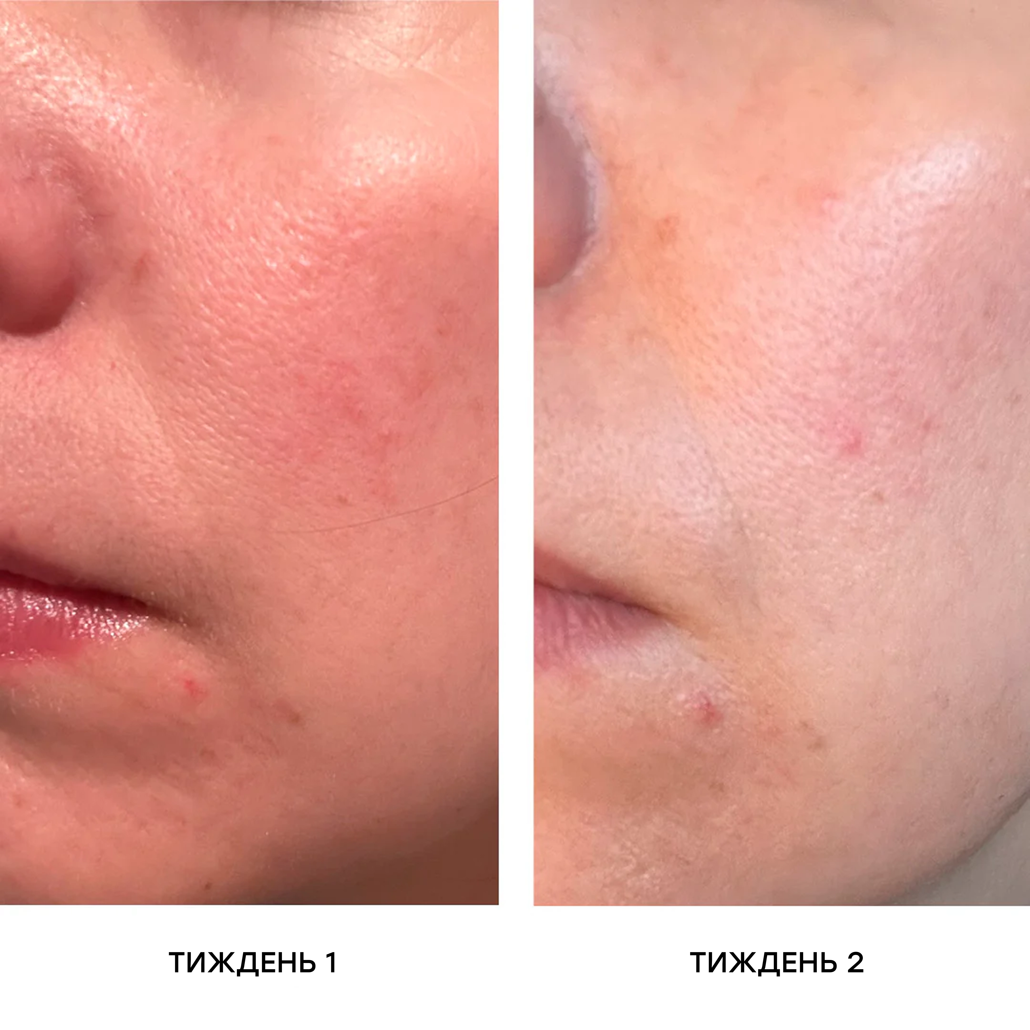 Сироватка з вітаміном C для сяйва та рівного тону шкіри The Wow Serum – Illuminating Vitamin C Serum MANTLE Обʼєм 30 мл — фото 5