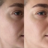 Увлажняющие пады с муцином медузы для сияния и гладкости кожи The Hydra Pads – Daily Hydrating Exfoliation Pads MANTLE — фото 4