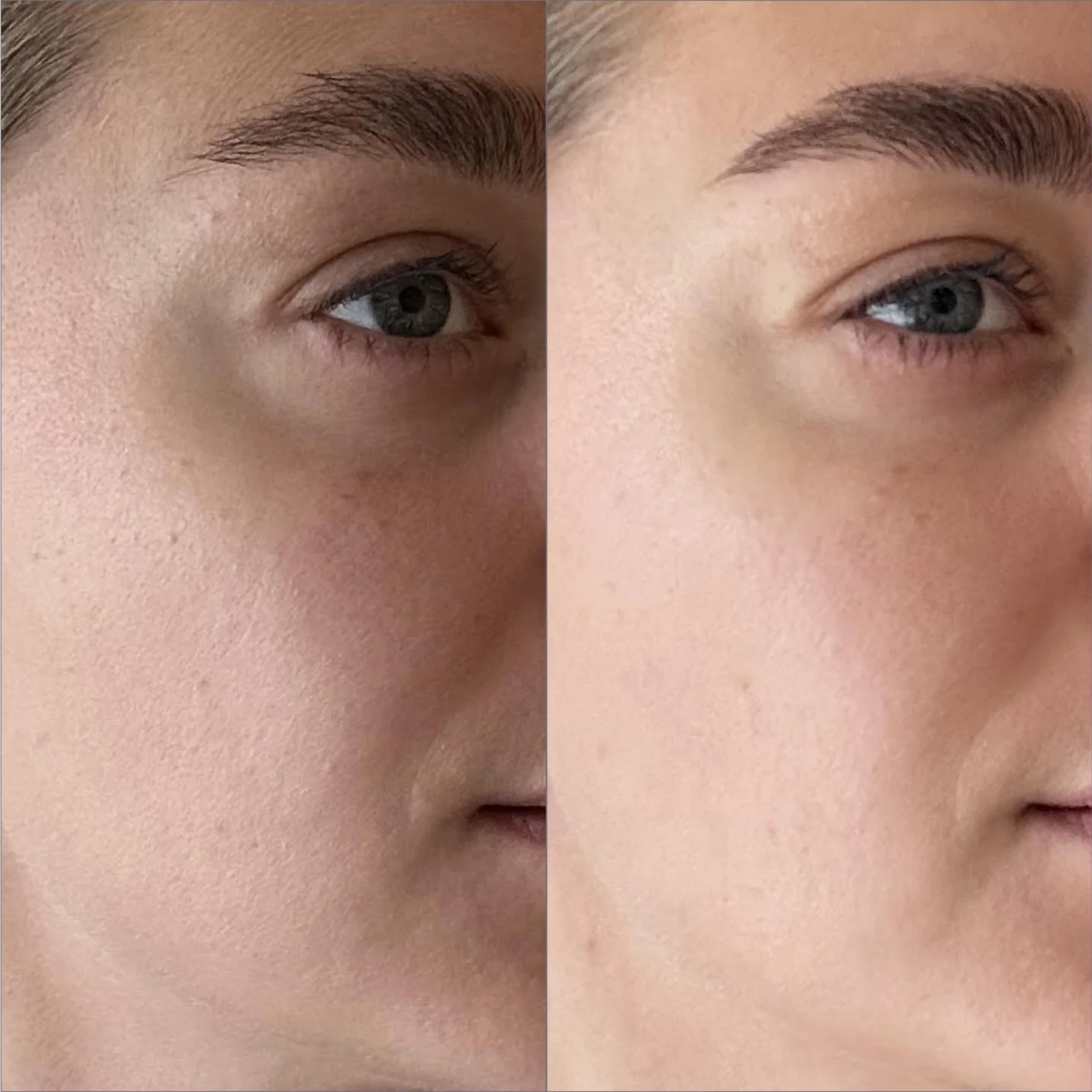 Увлажняющие пады с муцином медузы для сияния и гладкости кожи The Hydra Pads – Daily Hydrating Exfoliation Pads MANTLE — фото 4