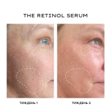 Сироватка з інкапсульованим ретинолом для оновлення шкіри The Retinol Serum – Transformative Vitamin A Complex MANTLE Обʼєм 30 мл — фото 5