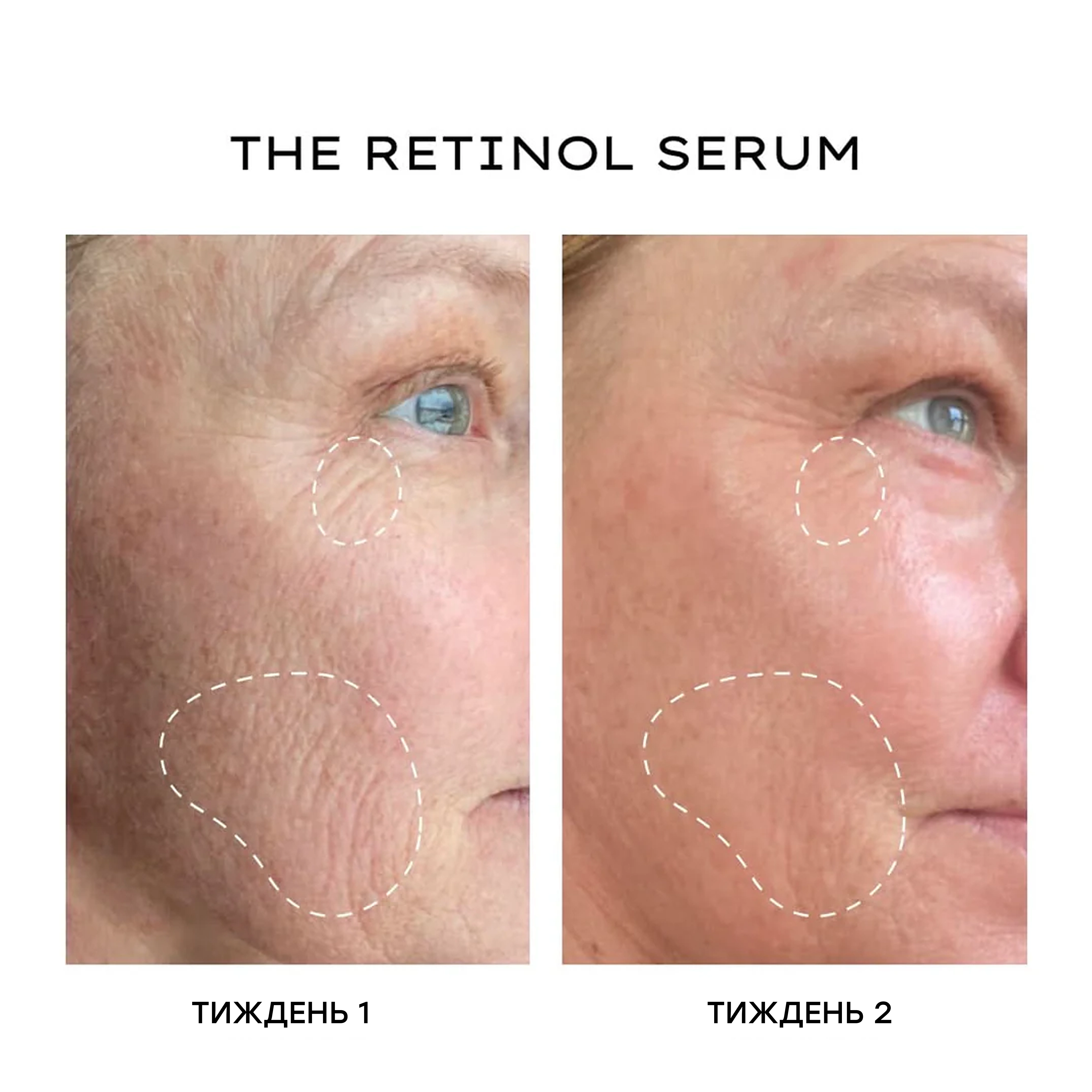 Сироватка з інкапсульованим ретинолом для оновлення шкіри The Retinol Serum – Transformative Vitamin A Complex MANTLE Обʼєм 30 мл — фото 5