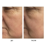 Маска з AHA- та PHA-кислотами для сяйва та оновлення шкіри The Miracle Mask – Resurfacing Glow-Up Mask MANTLE Обʼєм 75 мл — фото 7
