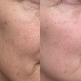 Крем для клітинного оновлення та пружності шкіри The Longevity Cream – Cellular Regeneration Moisturiser MANTLE Обʼєм 50 мл — фото 5